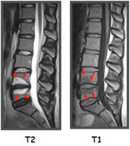 espine estructure