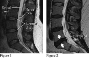 spinal x ray